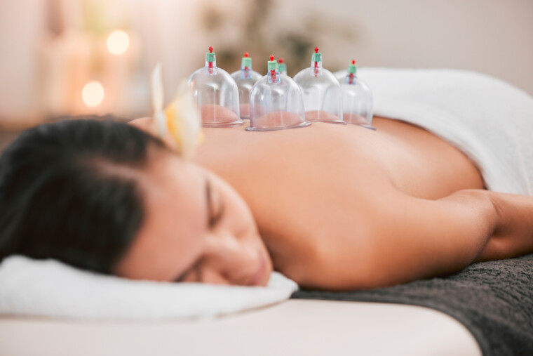 Heilpraxis Stuhlemmer Cupping Therapy
